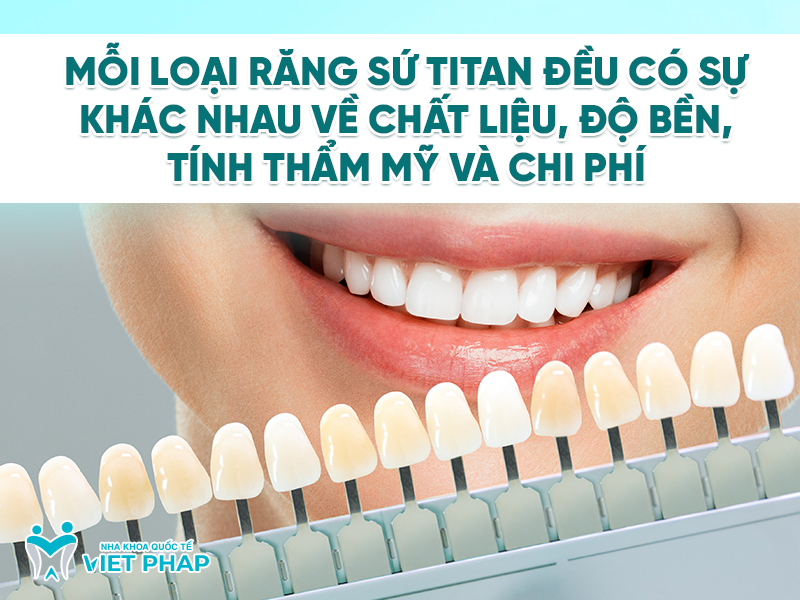 rang su titan co may loai 3 Mỗi loại răng sứ titan có sự khác nhau về chất liệu, độ bền, tính thẩm mỹ và chi phí