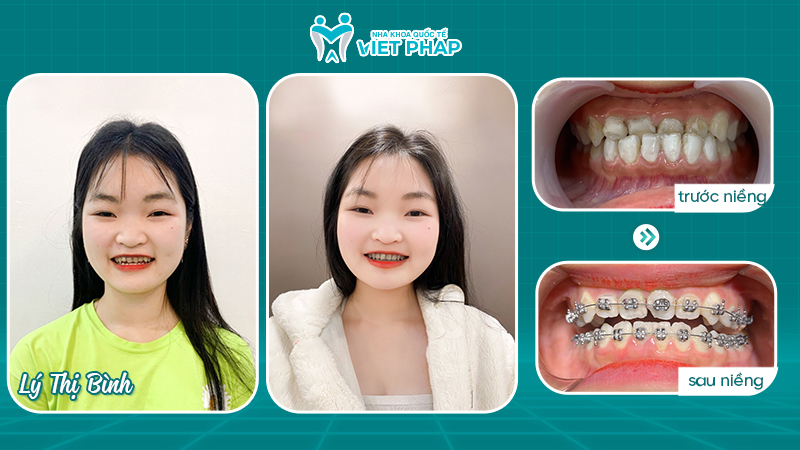 Ly Thi Binh 1 Khách hàng Lý Thị Bình