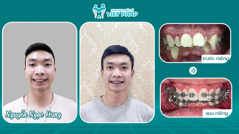 Khách hàng Nguyễn Ngọc Hưng