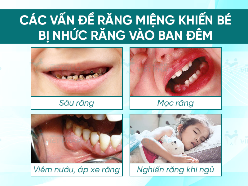 Các vấn đề về răng miệng khiến bé bị nhức răng vào ban đêm