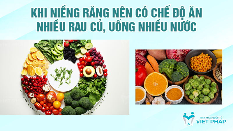 cac luu y khi nieng rang 7 Khi niềng răng nên ăn nhiều rau củ, uống nhiều nước