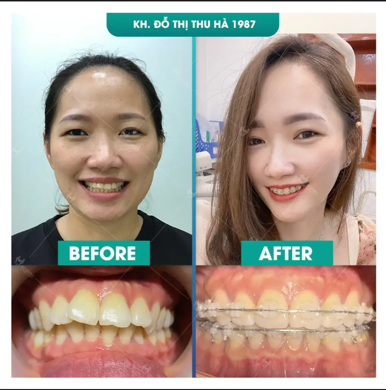 do thi thu ha Khách hàng Đỗ Thị Thu Hà