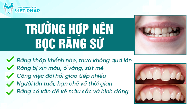 Các trường hợp nên bọc răng sứ