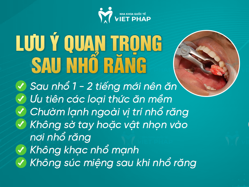 Lưu ý sau khi nhổ răng đau nhức 