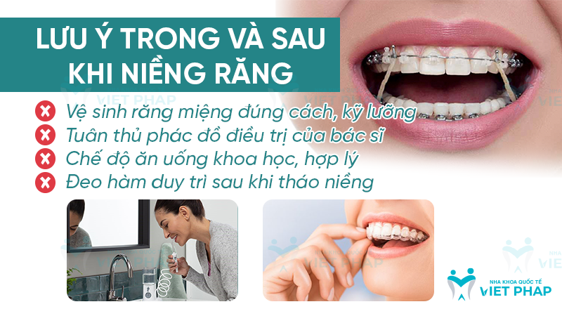 truoc va sau khi nieng rang 6 Lưu ý trong và sau khi niềng răng