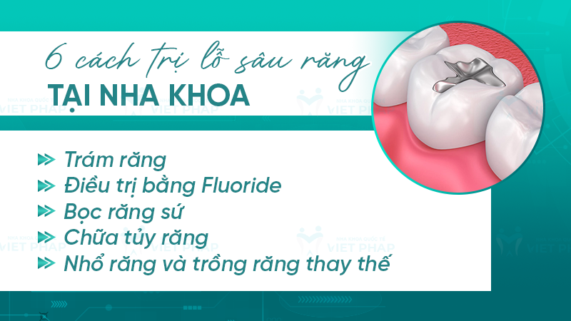 6 cách trị lỗ sâu răng tại nha khoa