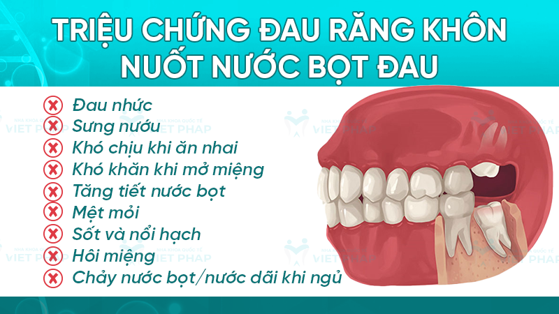 Triệu chứng đau răng khôn nuốt nước bọt đau