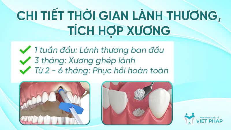 ghep xuong nha khoa quoc te viet phap 6 Chi tiết thời gian lành thương, tích hợp xương
