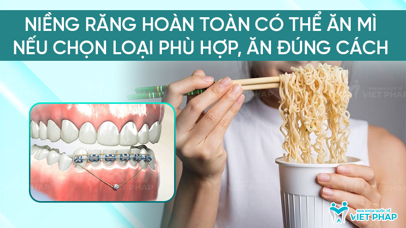 nieng rang an mi duoc khong nha khoa quoc te viet phap 1 Niềng răng hoàn toàn có thể ăn mì nếu chọn loại phù hợp, ăn đúng cách