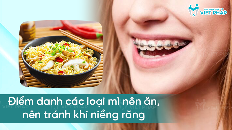 nieng rang an mi duoc khong nha khoa quoc te viet phap 2 Các loại mì nên ăn và nên tránh khi niềng răng