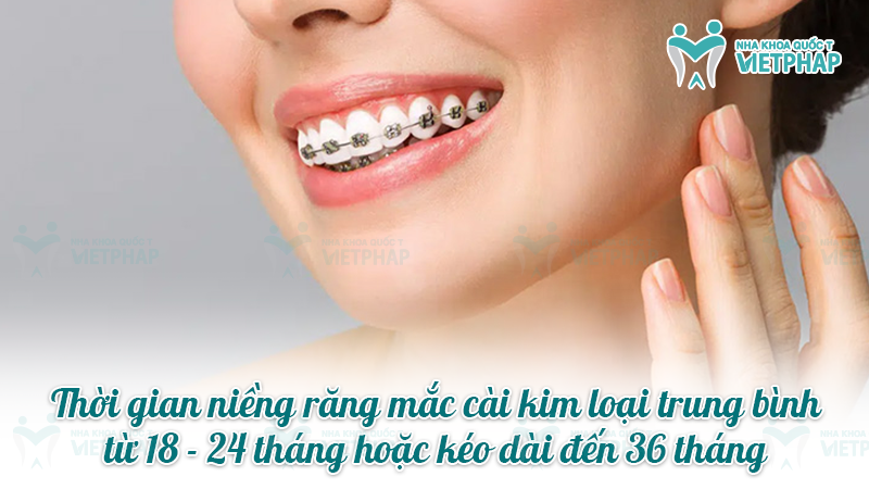 Thời gian niềng răng mắc cài kim loại trung bình từ 18 - 24 tháng hoặc kéo dài đến 36 tháng