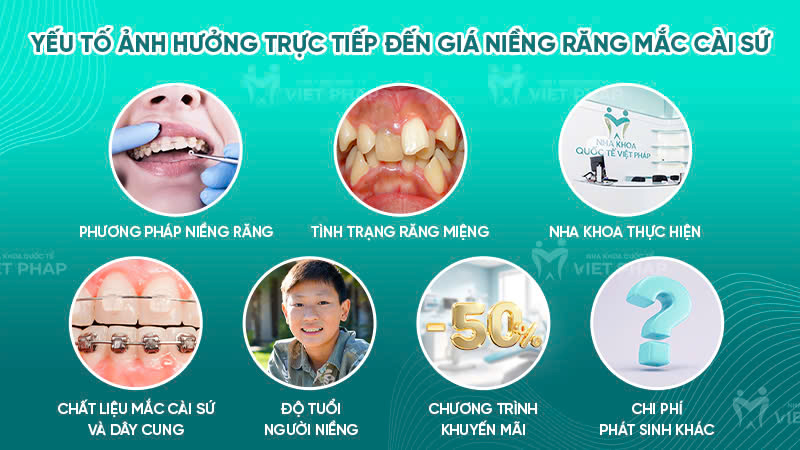 nieng rang mac cai su gia bao nhieu 5 Các yếu tố ảnh hưởng đến giá niềng răng mắc cài sứ
