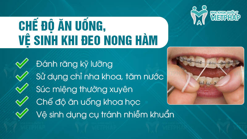 Chế độ ăn uống và vệ sinh khi đeo nong hàm