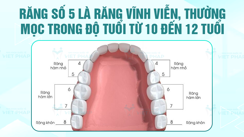 Răng số 5 là răng vĩnh viễn, thường mọc trong độ tuổi từ 10 đến 12 tuổi