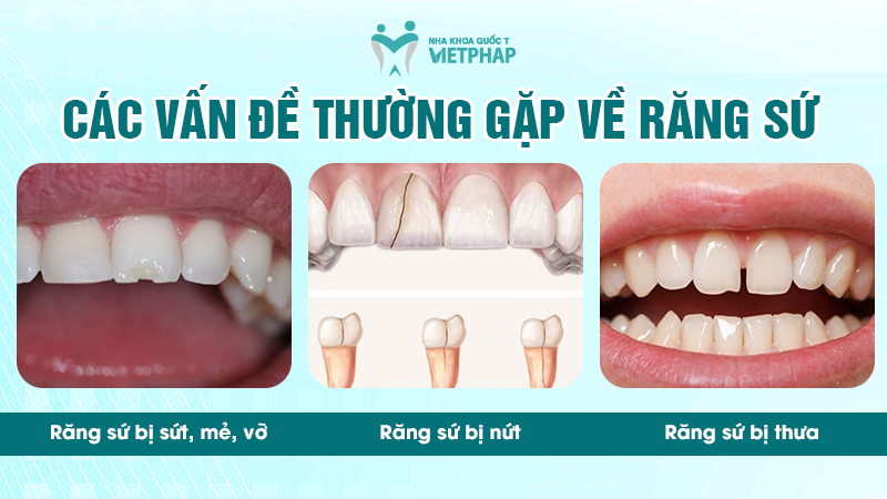 Các vấn đề thường gặp về răng sứ 