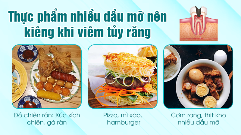 Thực phẩm nhiều dầu mỡ nên kiêng khi viêm tủy răng