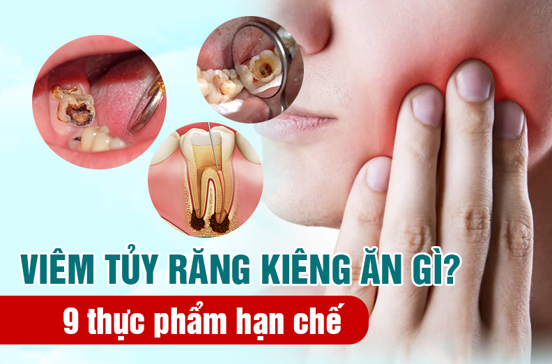 Viêm tủy răng kiêng ăn gì? 9 thực phẩm hạn chế