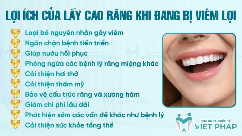 Lợi ích của lấy cao răng khi đang bị viêm lợi
