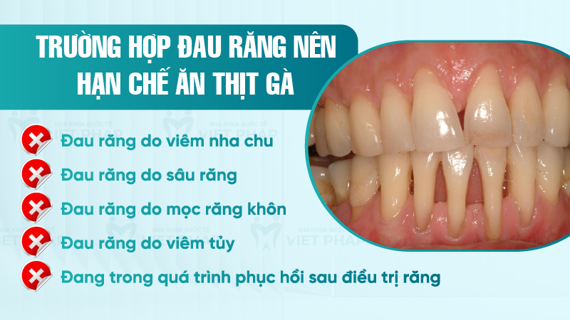 Trường hợp đau răng nên hạn chế ăn thịt gà