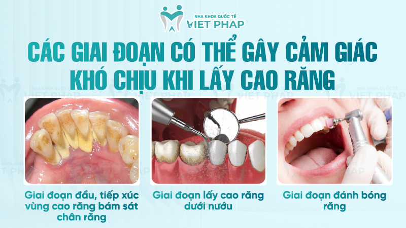 Các giai đoạn có thể gây cảm giác khó chịu khi lấy cao răng
