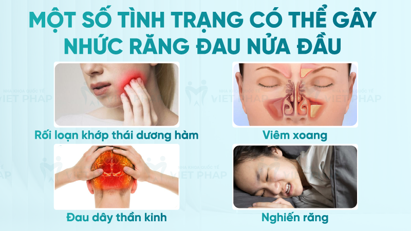 Nhuc rang dau nua dau phai lam sao 5 Một số tình trạng có thể gây nhức răng đau nửa đầu