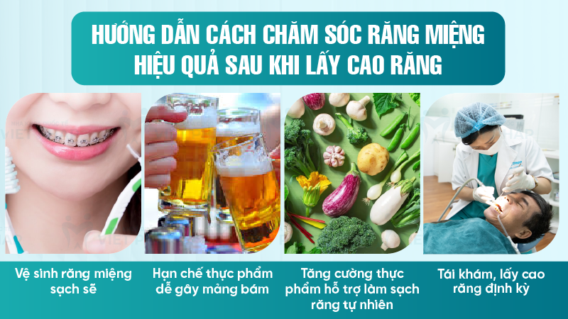 bao lau lay cao rang mot lan nha khoa quoc te viet phap 7 Hướng dẫn cách chăm sóc răng miệng hiệu quả sau khi lấy cao răng