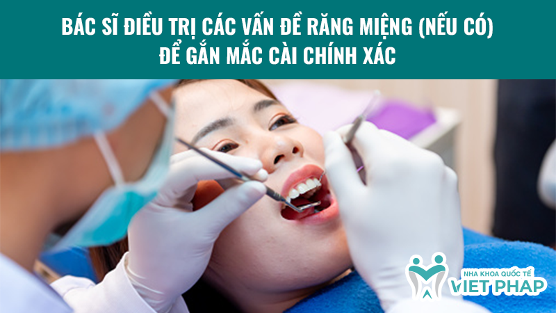 cach gan mac cai nieng rang 1.3 Bác sĩ điều trị các vấn đề răng miệng (nếu có) để gắn mắc cài chính xác