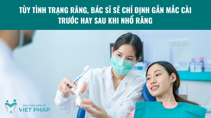 cach gan mac cai nieng rang 6 Tùy tình trạng răng, bác sĩ sẽ chỉ định gắn mắc cài trước hay sau khi nhổ răng