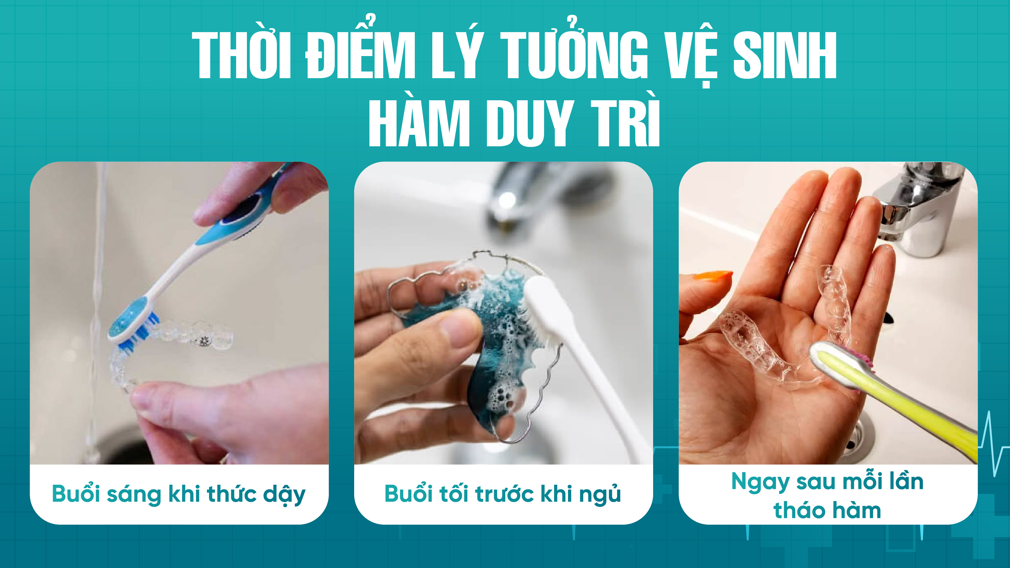 Thời điểm lý tưởng để vệ sinh hàm duy trì