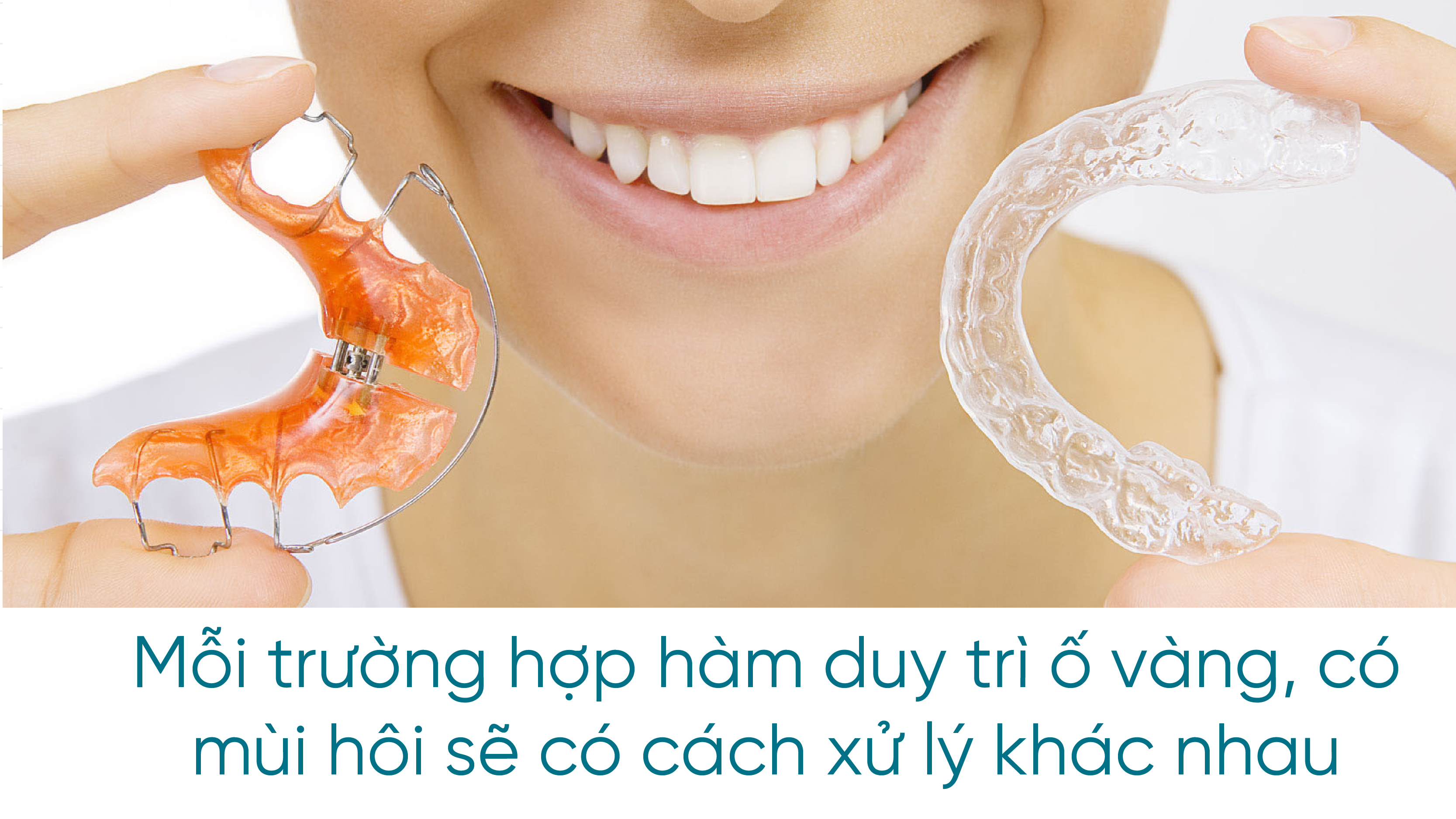 Mỗi trường hợp hàm duy trì ố vàng, có mùi hôi sẽ có cách xử lý khác nhau