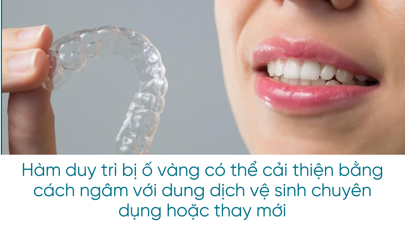 Hàm duy trì bị ố vàng có thể tảo thiện bằng cách ngâm với dung dịch vệ sinh chuyên dụng hoặc thay mới