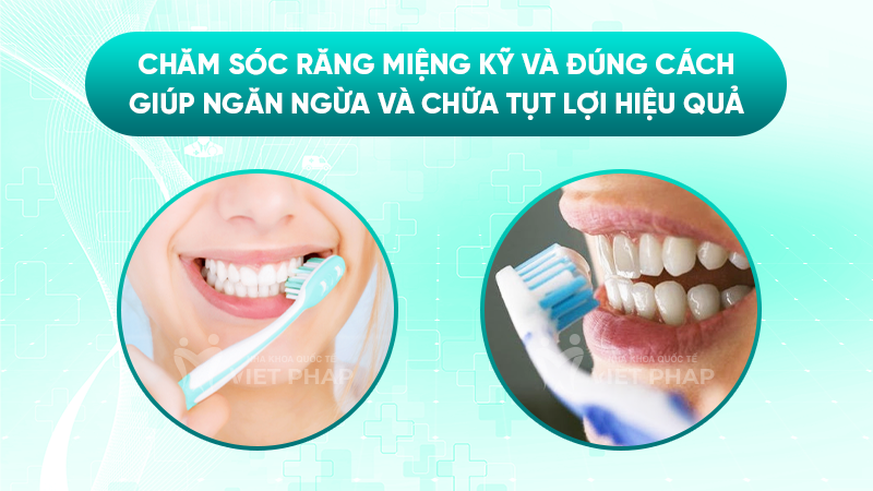 Chăm sóc răng miệng đúng cách giúp ngăn ngừa tụt lợi hiệu quả