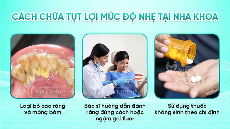 Cách chữa tụt lợi mức độ nhẹ tại nha khoa