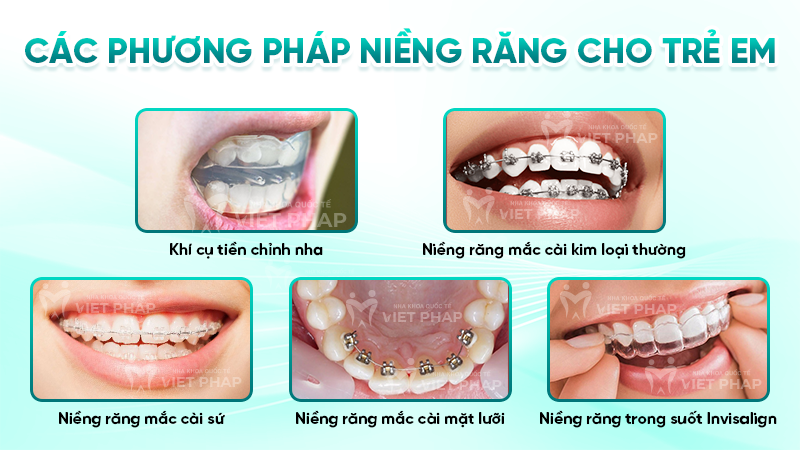 Các phương pháp niềng răng cho trẻ em