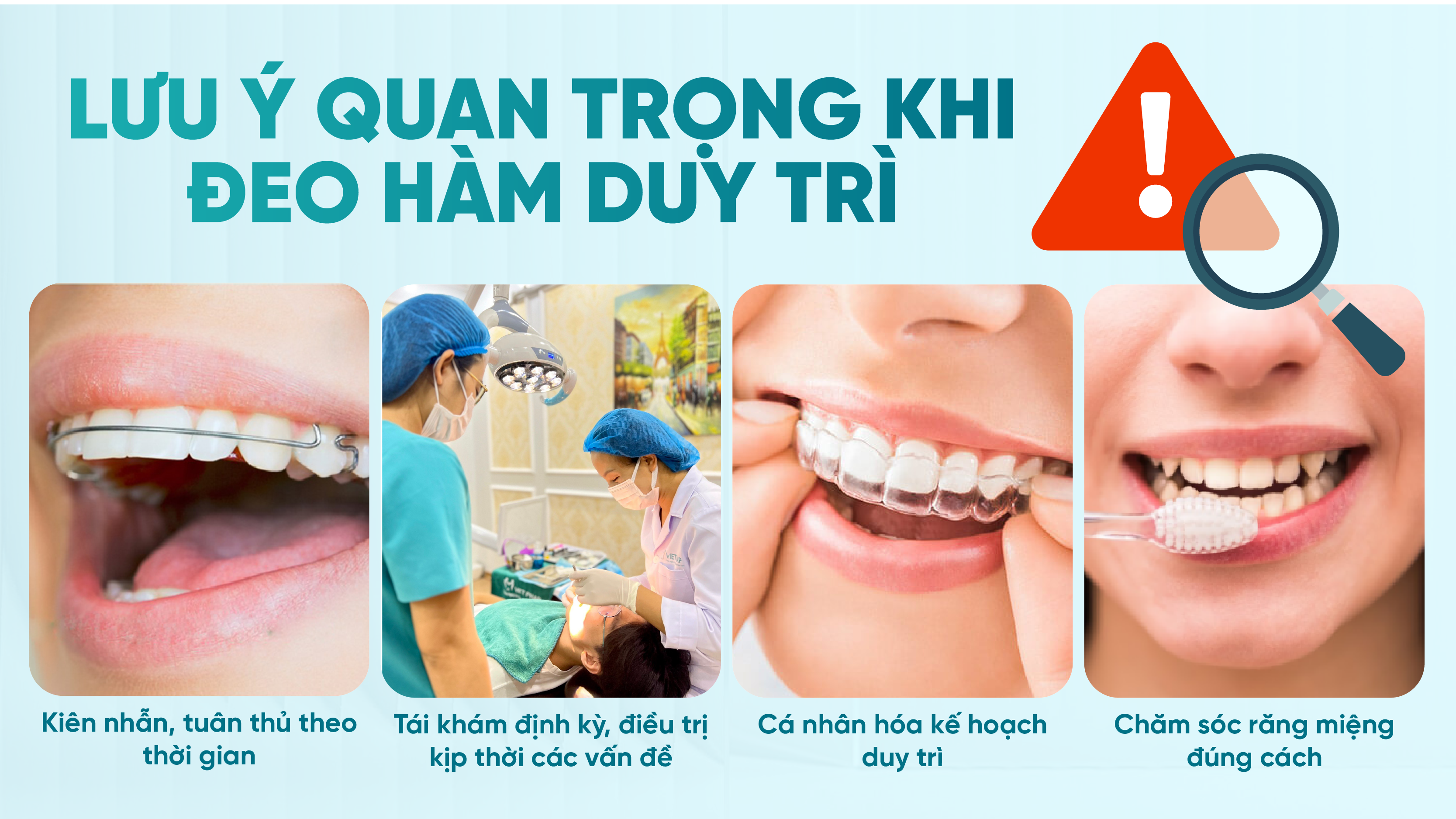 Lưu ý quan trọng khi đeo hàm duy trì