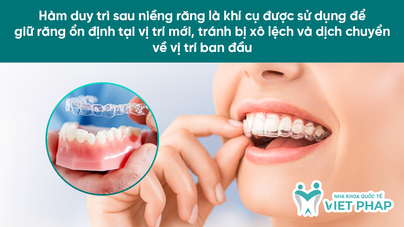 Hàm duy trì sau niềng răng là khí cụ được sử dụng để giữ răng ổn định tại vị trí mới, tránh bị xô lệch và dịch chuyển về vị trí ban đầu 