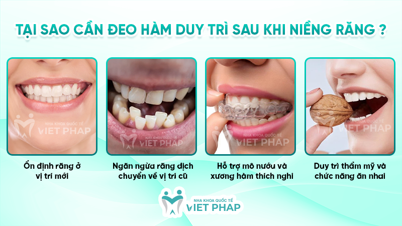 Tại sao cần đeo hàm duy trì sau khi niềng răng?