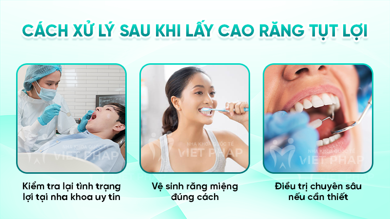 lay cao rang xong bi tut loi 3.3 Cách xử lý sau khi lấy cao răng tụt lợi