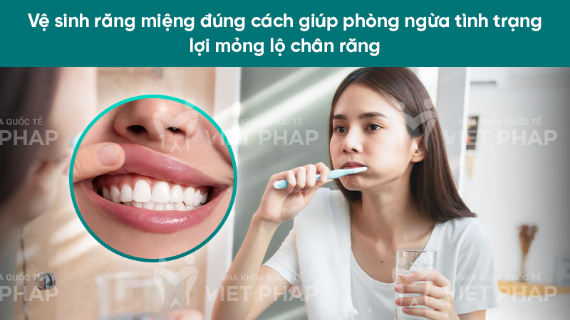 Vệ sinh răng miệng đúng cách giúp phòng ngừa tình trạng lợi mỏng lộ chân răng