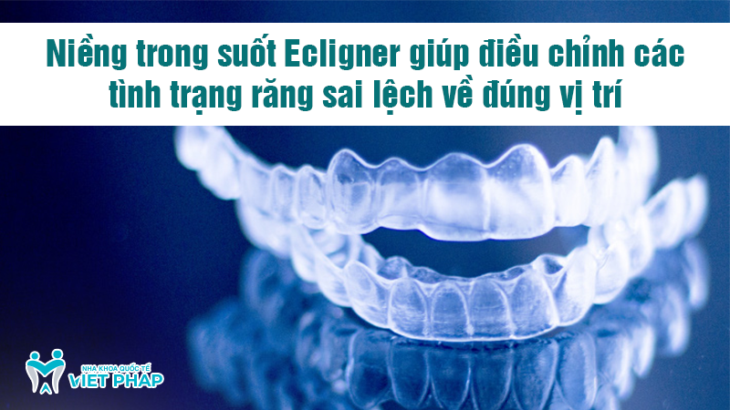 nieng rang trong suot Ecligner nha khoa quoc te viet phap 2 Niềng trong suốt Ecligner giúp điều chỉnh các tình trạng răng sai lệch về đúng vị trí