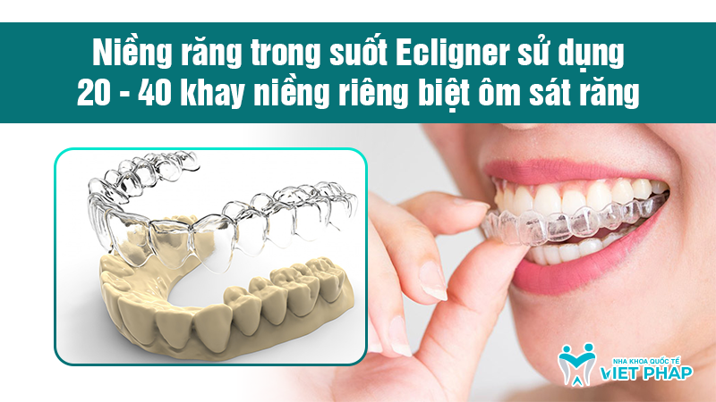 nieng rang trong suot Ecligner nha khoa quoc te viet phap 3 Cơ chế hoạt động của niềng răng trong suốt Ecligner