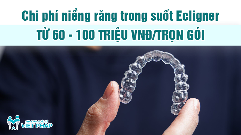 nieng rang trong suot Ecligner nha khoa quoc te viet phap 7 Chi phí niềng răng trong suốt Ecligner từ 60 - 100 triệu VNĐ/trọn gói
