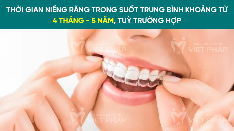 Thời gian niềng răng trong suốt trung bình khoảng từ 4 tháng - 5 năm, tuỳ trường hợp