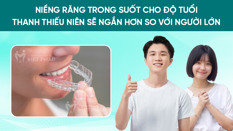 Niềng răng trong suốt cho độ tuổi thanh thiếu niên sẽ ngắn hơn so với người lớn 