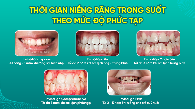 Thời gian niềng răng trong suốt theo mức độ phức tạp