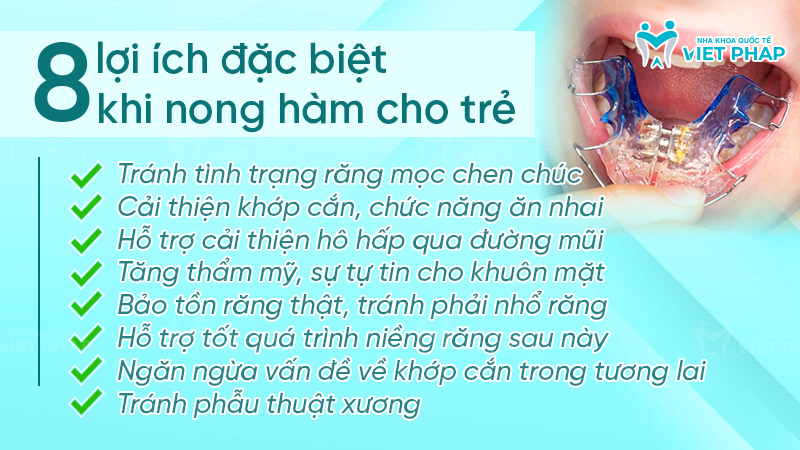 Lợi ích của nong hàm đối với sự phát triển răng miệng của trẻ
