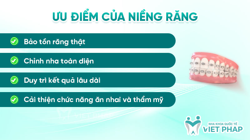 Ưu điểm của niềng răng
