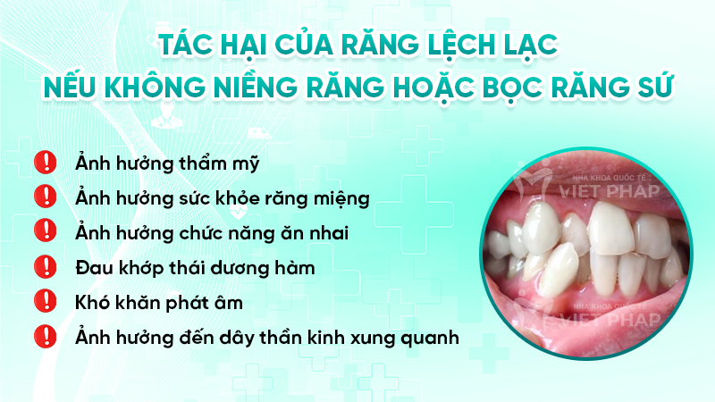 Tác hại của răng lệch lạc nếu không niềng răng hoặc bọc răng sứ