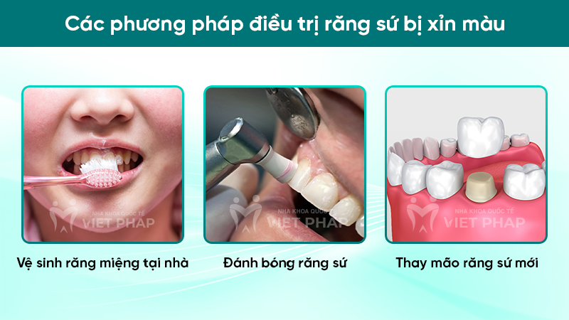 rang su xin mau 3 Các phương pháp điều trị răng sứ bị xỉn màu