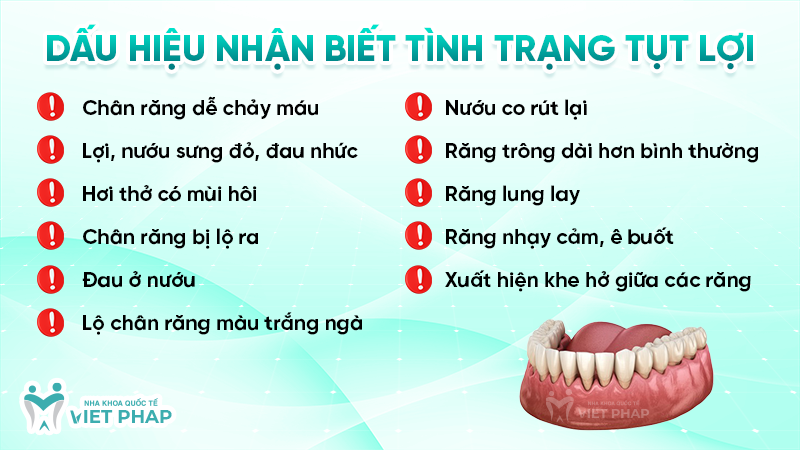 tut loi 2 Dấu hiệu nhận biết tình trạng tụt lợi